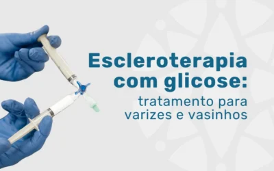 Home 7 Escleroterapia com glicose para varizes e vasinhos