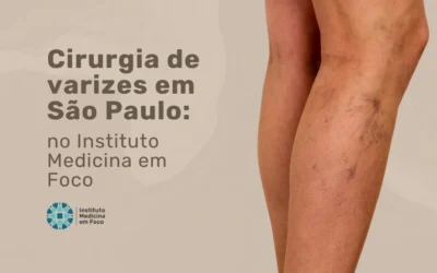 Home 7 Faça sua cirurgia de varizes em São Paulo na MEF