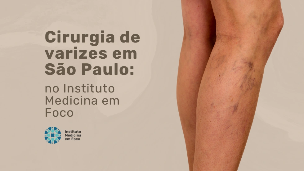 Faça sua cirurgia de varizes em São Paulo na MEF
