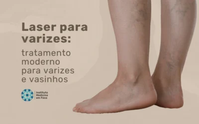 Home 7 Laser para varizes: tratamento para varizes e vasinhos