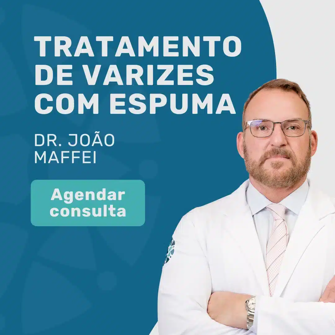 Entre em contato com o Insituto Medicina em Foco para agendar sua consulta com angiologista em São Paulo, Dr. João Maffei, para tratamento de varizes com escleroterapia com espuma