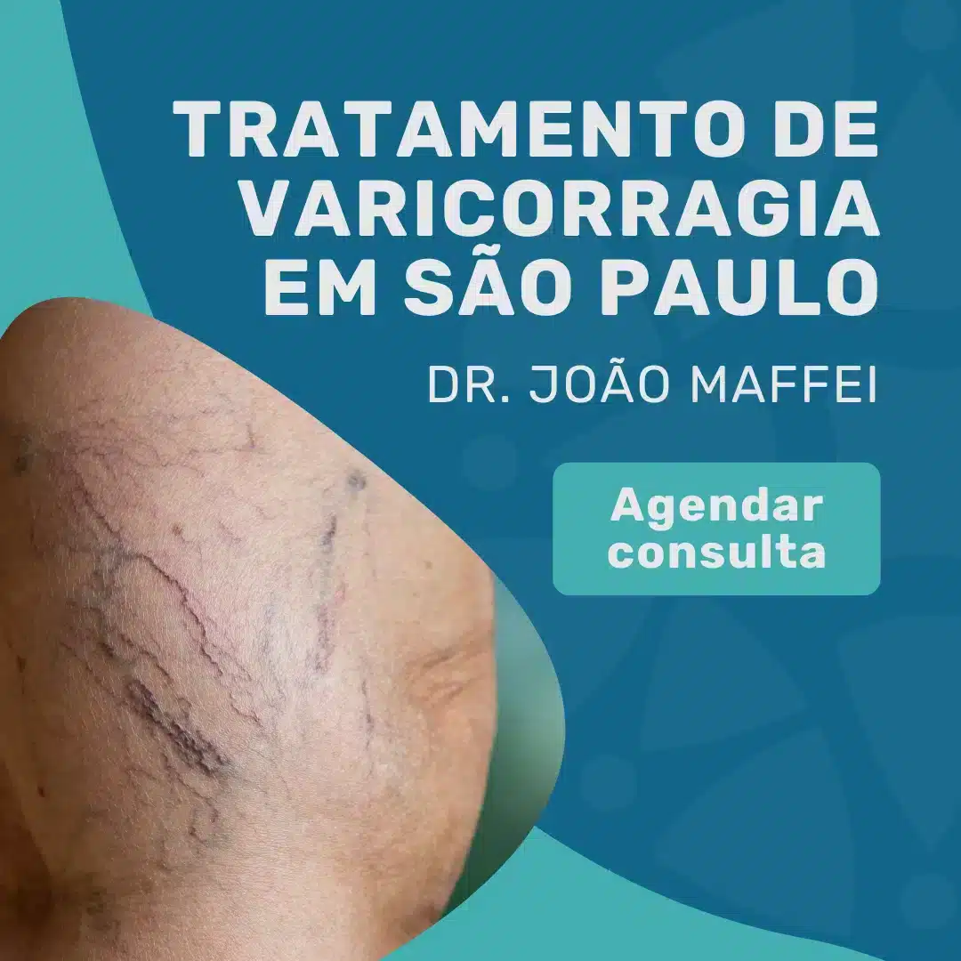 Entre em contato para agendar sua consulta com o Dr. João Maffei, cirurgião vascular em São Paulo, para tratamento de varicorragia em são paulo