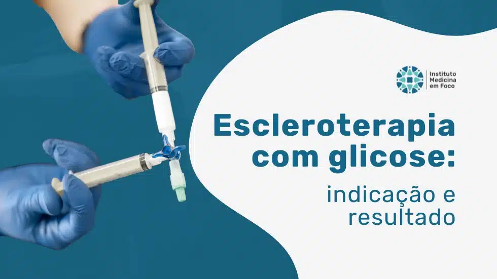 Arquivo medicina em foco 37 MEF - Diagnóstico preciso o sucesso da escleroterapia com glicose
