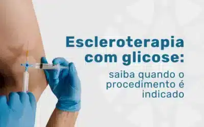 Escleroterapia com glicose não falha: o erro é a indicação