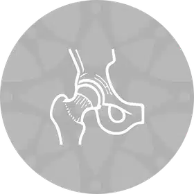 Cirurgia do Quadril em São Paulo