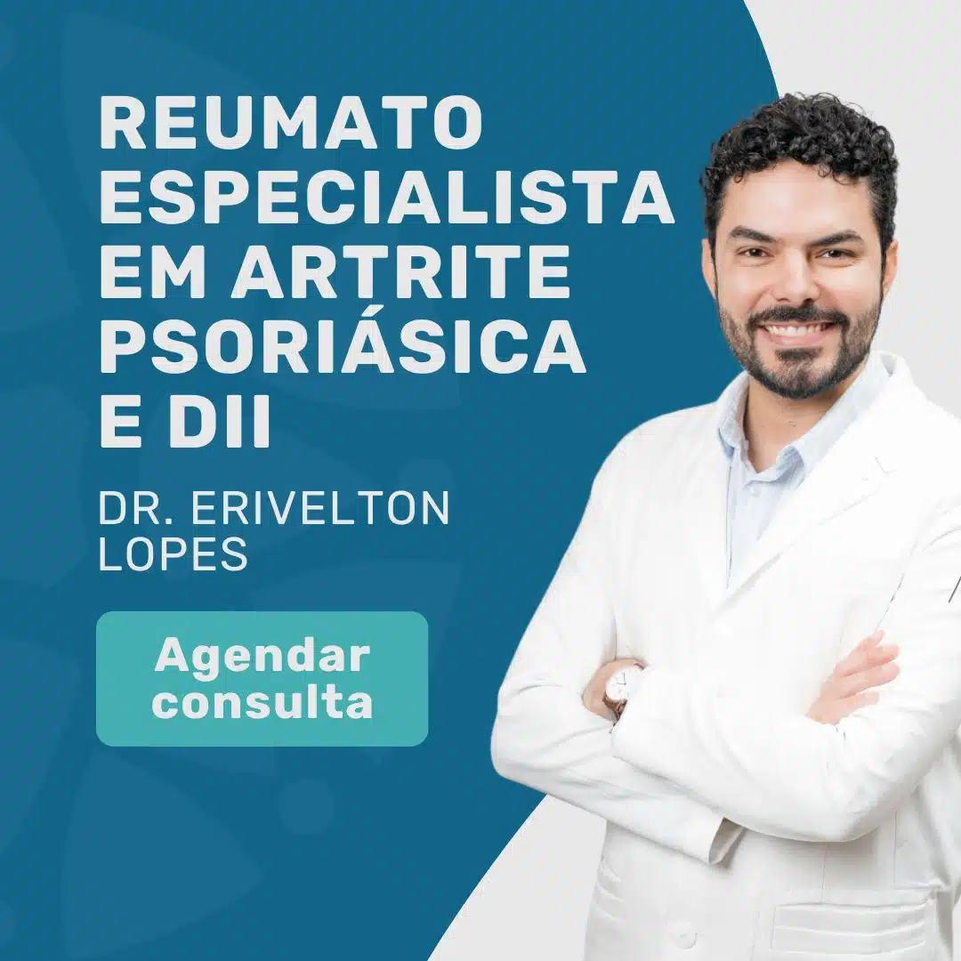 Dr. Erivelton Lopes, Reumatologista para Artrite Psoriásica 1 Olá, vim do site da Medicina em Foco e gostaria de mais informações sobre consulta com Reumatologista Especialista em Psoríase!