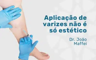 Home 7 Aplicação de varizes além do tratamento estético