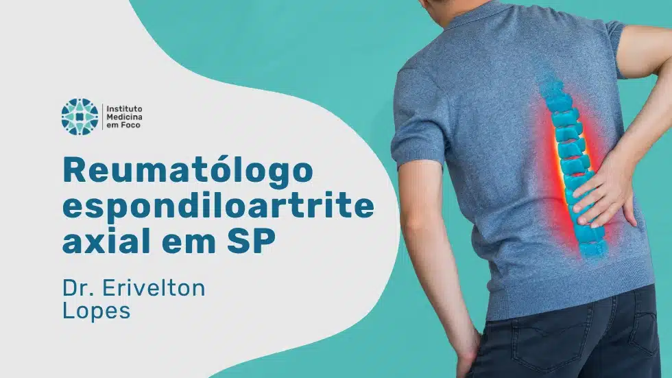 Reumatólogo para espondiloartrite axial em SP