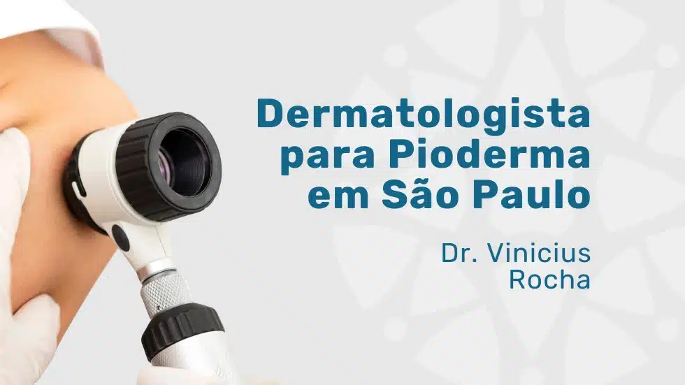 Dr. Vinicius Rocha: Dermatologista para pioderma