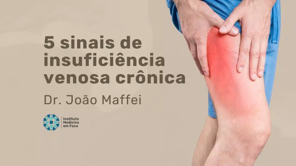 Compreenda os 5 sinais de insuficiência venosa crônica
