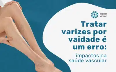 Tratar varizes por vaidade é um erro: entenda os impactos