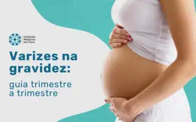Varizes na gravidez: guia trimestre a trimestre