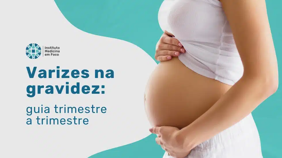 Varizes na gravidez: guia trimestre a trimestre