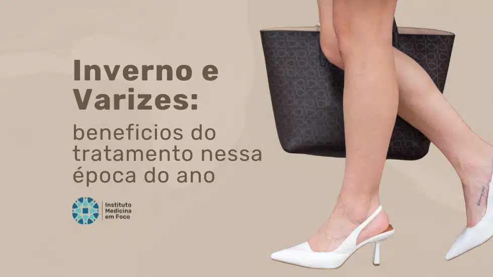 Planejamento do tratamento de varizes no inverno