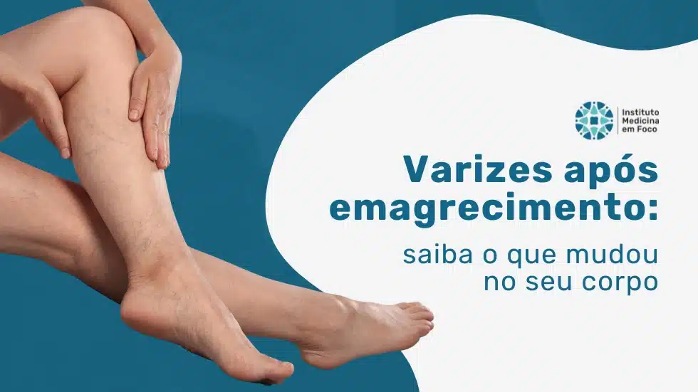 Veias aparentes após uso de GLP-1: causa ou revelação?