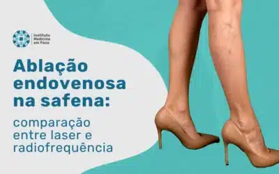 Ablação endovenosa da safena: laser (EVLA) e radiofrequência