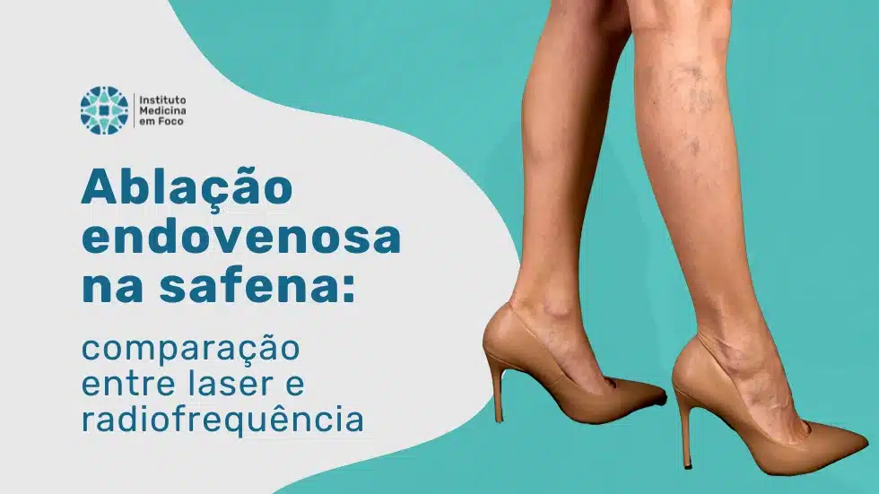 Ablação endovenosa da safena: laser (EVLA) e radiofrequência