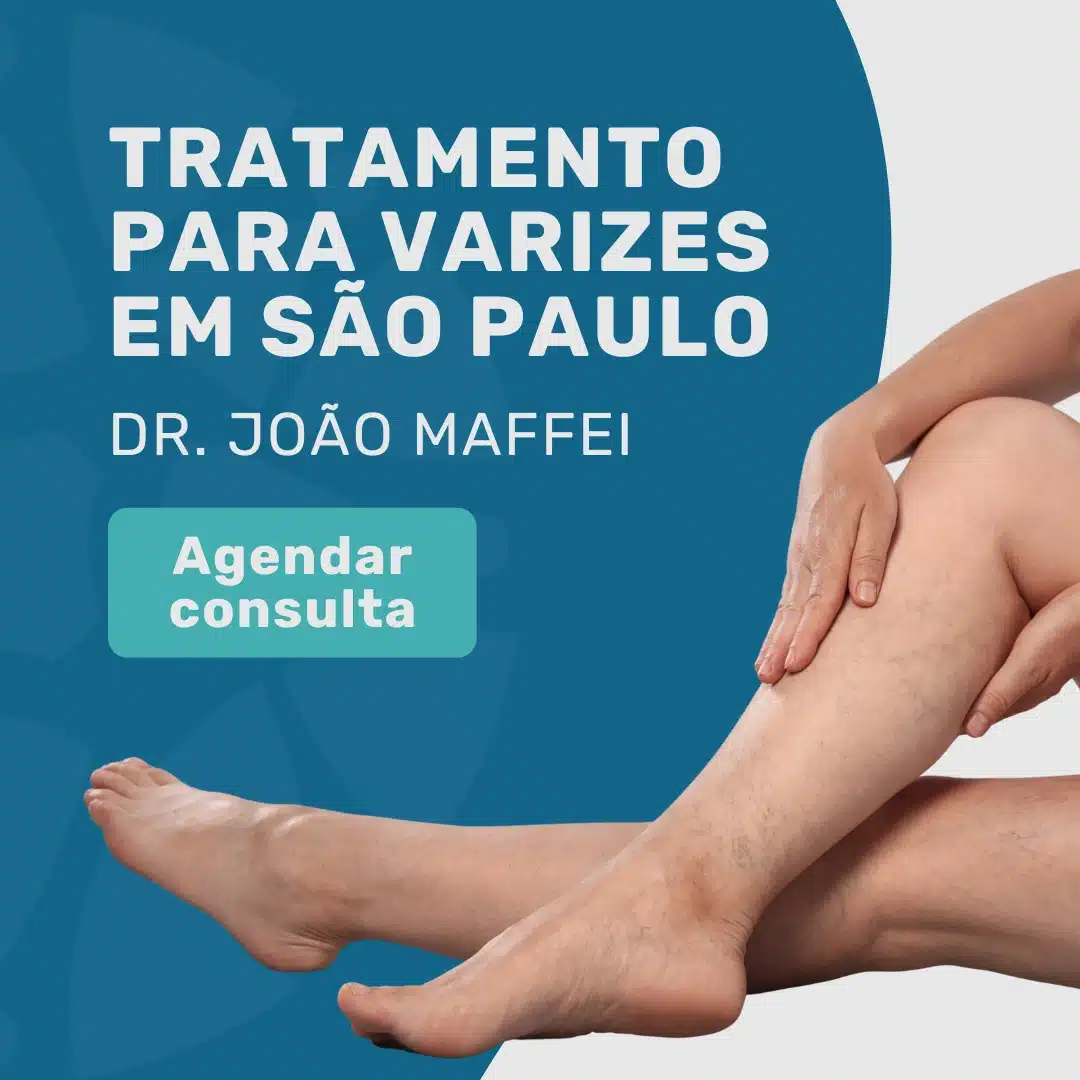 Varizes têm cura? O que a medicina vascular atual diz