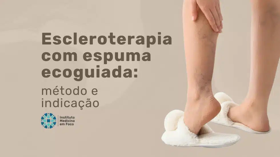 Escleroterapia com espuma ecoguiada (UGFS): como funciona?