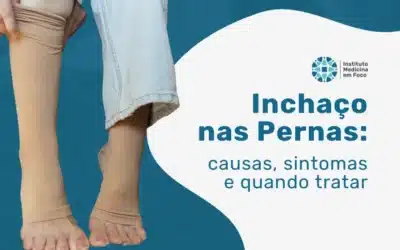 Tratamento do inchaço nas pernas: qual especialista procurar