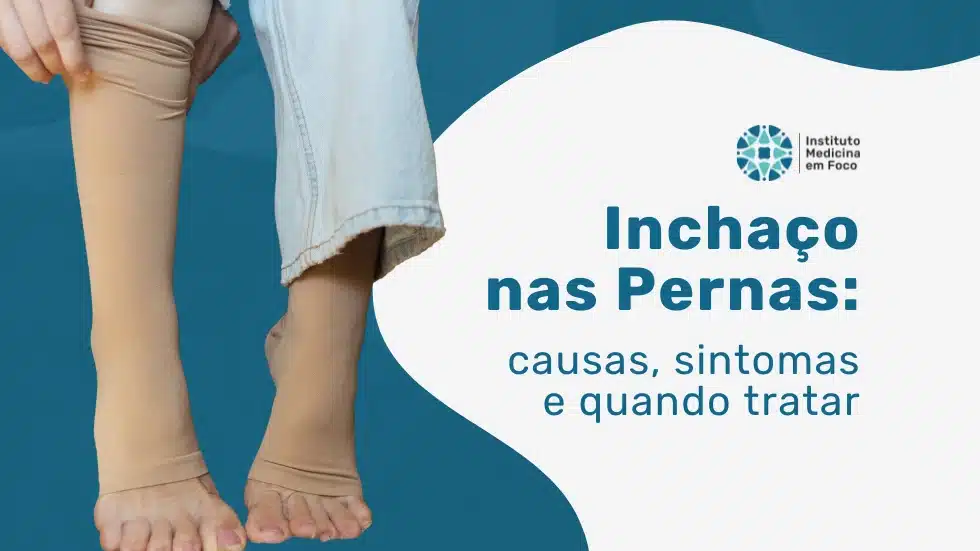 Tratamento do inchaço nas pernas: qual especialista procurar