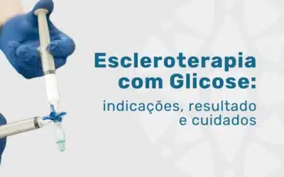 Escleroterapia com glicose: protocolo e indicações