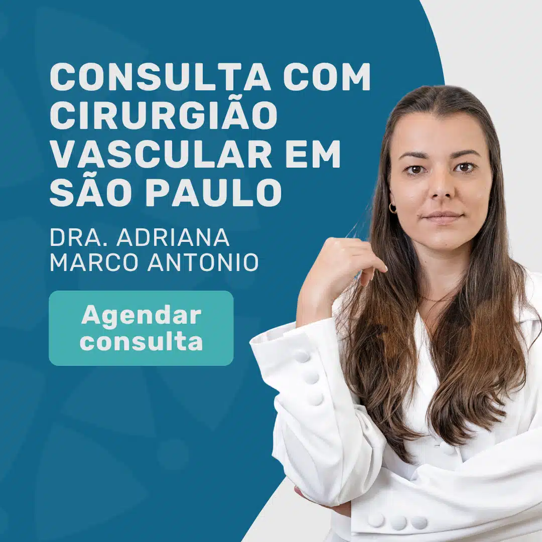 dra adriana marco antonio consulta com cirurgiao vascular em sao paulo