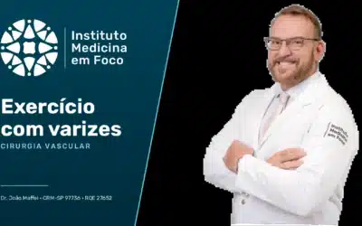 Exercício com varizes: o que diz a fisiologia venosa