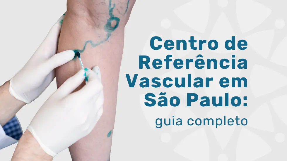Centro de referência vascular em São Paulo: guia completo