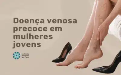 Doença venosa precoce em mulheres jovens: por que acontece e quando investigar