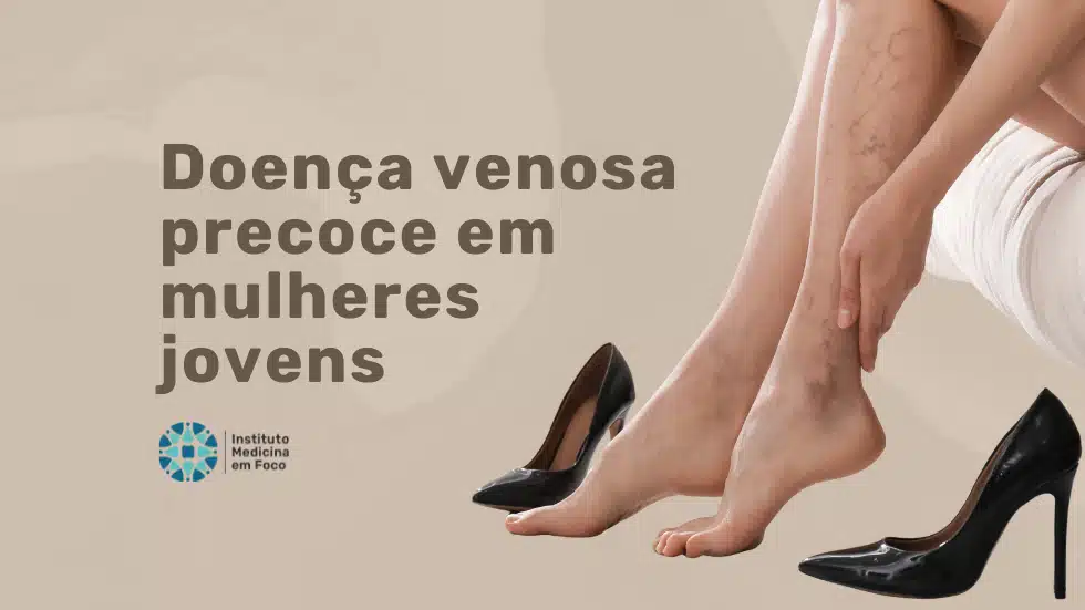 Doença venosa precoce em mulheres jovens: por que acontece e quando investigar