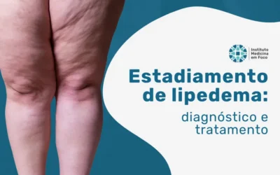 Estadiamento de lipedema: diagnóstico e tratamento