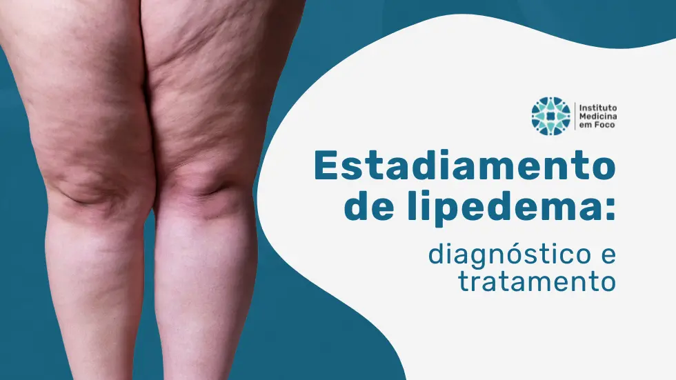 Estadiamento de lipedema: diagnóstico e tratamento