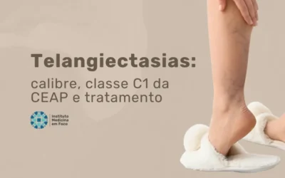 Telangiectasias: calibre, classe C1 da CEAP e tratamento