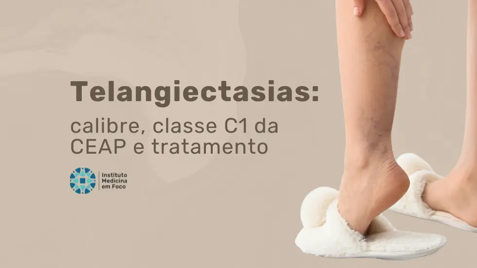 Telangiectasias: calibre, classe C1 da CEAP e tratamento