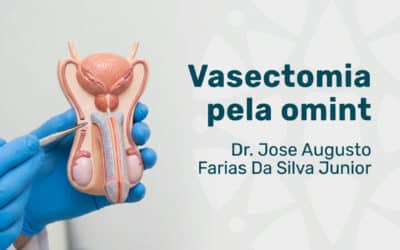 Vasectomia pela Omint