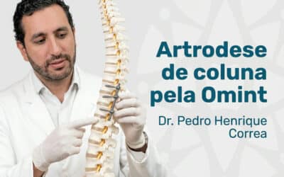 Artrodese de coluna pela Omint
