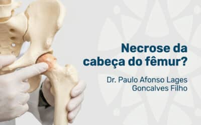 Necrose da cabeça do fêmur: dá para evitar a prótese?