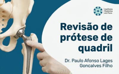 Revisão de prótese de quadril: quando a primeira falha